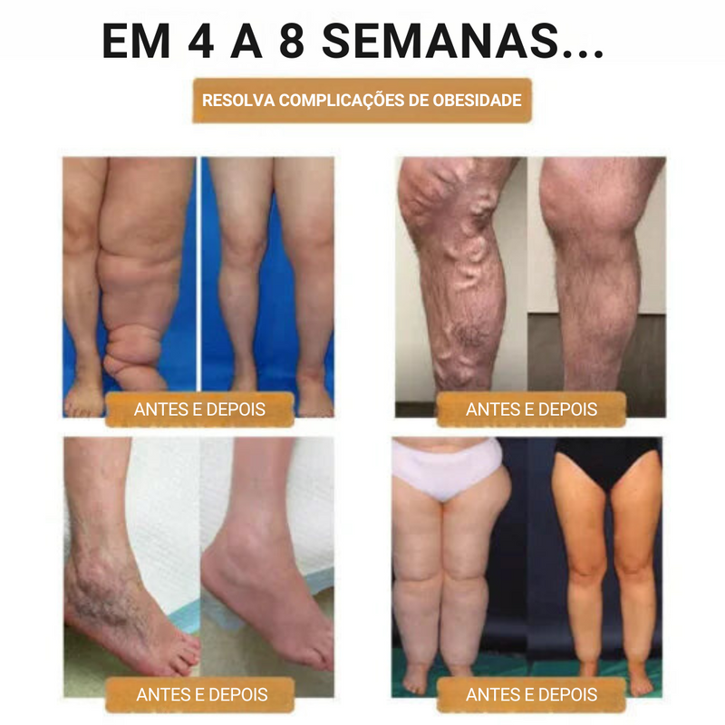 Relógio Detox SlimFit ⌚️ Reduza a Gordura e Desintoxique o Corpo de Forma Natural!